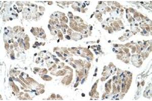 Immunohistochemical staining (Formalin-fixed paraffin-embedded sections) of human muscle with CHST1 polyclonal antibody  at 4-8 ug/mL working concentration. (CHST1 anticorps  (N-Term))