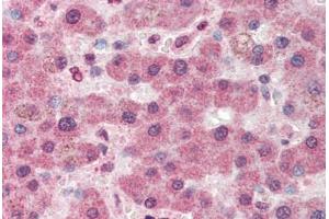 Human Liver (formalin-fixed, paraffin-embedded) stained with PC antibody ABIN337183 at 5 ug/ml followed by biotinylated anti-goat IgG secondary antibody ABIN481715, alkaline phosphatase-streptavidin and chromogen. (PC anticorps  (AA 886-899))