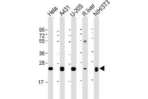 All lanes : Anti-RAB1B Antibody at 1:4000 dilution Lane 1: Hela whole cell lysate Lane 2: A431 whole cell lysate Lane 3: U-20S whole cell lysate Lane 4: rat liver lysate Lane 5: NIH/3T3 whole cell lysate Lysates/proteins at 20 μg per lane. (RAB1B anticorps  (AA 1-201))