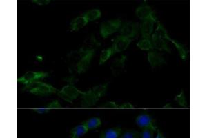 Immunofluorescence analysis of C6 cells using ATP6V0C Polyclonal Antibody at dilution of 1:100 (40x lens). (ATP6V0C anticorps)