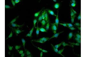 Immunofluorescence staining of Hela cells with ABIN7159933 at 1:100, counter-stained with DAPI. (LETM1 anticorps  (AA 443-543))