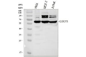 Western blot analysis of HRPT2/CDC73 using anti-HRPT2/CDC73 antibody (ABIN3043535).