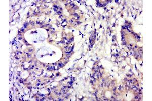 Paraformaldehyde-fixed, paraffin embedded human cervical carcinoma, Antigen retrieval by boiling in sodium citrate buffer (pH6.