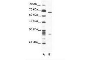 Image no. 1 for anti-Set1/Ash2 Histone Methyltransferase Complex Subunit ASH2 (ASH2L) (AA 54-103) antibody (ABIN202839) (ASH2L anticorps  (AA 54-103))