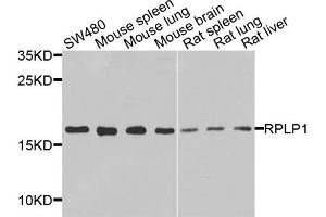 Western blot analysis of extracts of various cells, using RPLP1 antibody. (RPLP1 anticorps)