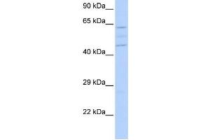 Western Blotting (WB) image for anti-Vacuolar Protein Sorting 37 Homolog A (VPS37A) antibody (ABIN2459607) (VPS37A anticorps)
