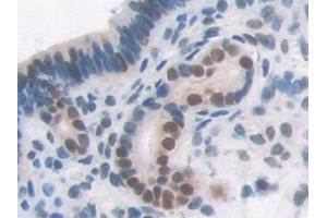 Detection of TALDO1 in Mouse Uterus Tissue using Polyclonal Antibody to Transaldolase (TALDO1)