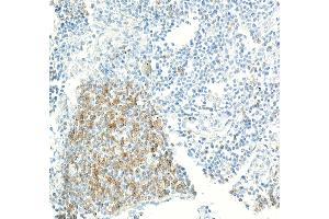 Immunohistochemistry (IHC) image for anti-CD70 Molecule (CD70) (AA 50-193) antibody (ABIN7795664) (Recombinant CD70 anticorps  (AA 50-193))