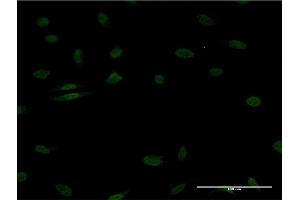 Immunofluorescence of monoclonal antibody to EGR1 on HeLa cell.