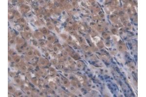 IHC-P analysis of Rat Stomach Tissue, with DAB staining. (RIPK1 anticorps  (AA 1-179))