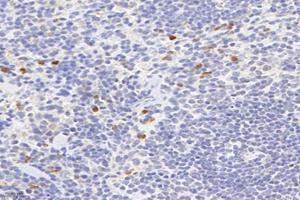 Immunohistochemistry analysis of paraffin-embedded mouse spleen using,Factor XIIIa (ABIN7073528) at dilution of 1: 2400 (F13A1 anticorps)