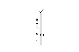 Anti-D Antibody (N-term) at 1:1000 dilution + PC-3 whole cell lysate Lysates/proteins at 20 μg per lane. (DAP anticorps  (N-Term))