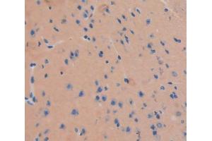 Used in DAB staining on fromalin fixed paraffin- embedded Kidney tissue