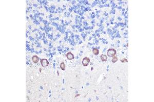 Immunohistochemistry of paraffin-embedded rat brain using PLC beta 3 (PLC beta 3 (PLCB3)) Rabbit pAb (ABIN6134972, ABIN6145749, ABIN6145750 and ABIN6214407) at dilution of 1:100 (40x lens). (PLCB3 anticorps  (AA 1050-1150))