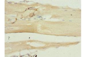 Immunohistochemistry of paraffin-embedded human skeletal muscle tissue using ABIN7169457 at dilution of 1:100 (SH2B1 anticorps  (AA 360-520))