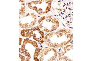 Immunohistochemical analysis of paraffin-embedded H.