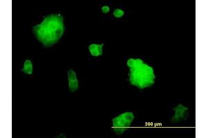 Immunofluorescence of monoclonal antibody to SSH3 on A-431 cell.