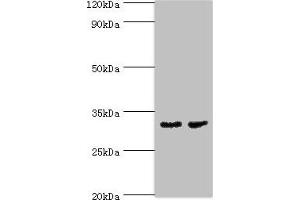 Western blot All lanes: CA8 antibody at 4 μg/mL Lane 1: Mouse skeletal muscle tissue Lane 2: Mouse liver tissue Secondary Goat polyclonal to rabbit IgG at 1/10000 dilution Predicted band size: 33 kDa Observed band size 33 kDa (CA8 anticorps  (AA 1-290))