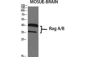 Western Blot (WB) analysis of specific cells using Rag A/B Polyclonal Antibody. (RagA/B (C-Term) anticorps)