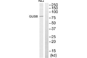 Western blot analysis of extracts from HeLa cells, using GUSB antibody.
