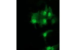 Image no. 3 for anti-Ubiquitin-Conjugating Enzyme E2S (UBE2S) antibody (ABIN1501643) (UBE2S anticorps)