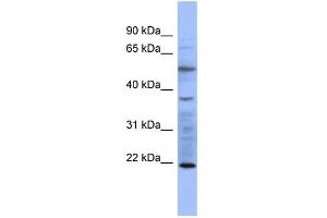 WB Suggested Anti-MYL3 Antibody Titration:  0. (MYL3/CMLC1 anticorps  (N-Term))
