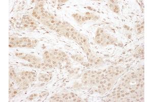 Immunohistochemistry (IHC) image for anti-Cyclin-Dependent Kinase 4 (CDK4) (AA 253-303) antibody (ABIN7455013) (CDK4 anticorps  (AA 253-303))