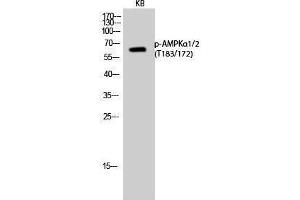 Western Blotting (WB) image for anti-AMPK1/AMPK2 (pThr172), (pThr183) antibody (ABIN3173192) (PRKAA1/PRKAA2 anticorps  (pThr172, pThr183))