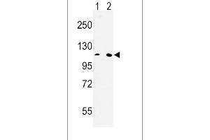Western blot analysis of MTTP Antibody (C-term) (ABIN653011 and ABIN2842637) in Hela(lane 1), 293(lane 2) cell line lysates (35 μg/lane). (MTTP anticorps  (C-Term))