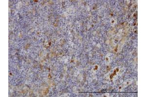 Immunoperoxidase of monoclonal antibody to FGR on formalin-fixed paraffin-embedded human lymph node. (Fgr anticorps  (AA 1-90))