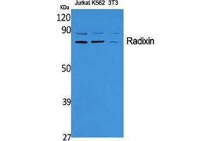 Western Blot (WB) analysis of specific cells using Radixin Polyclonal Antibody. (Radixin anticorps  (Internal Region))