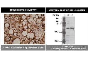 Immunohistochemistry (IHC) image for anti-Cytochrome P450, Family 4, Subfamily F, Polypeptide 11 (CYP4F11) (C-Term) antibody (ABIN264503)