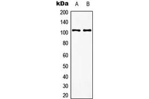 Western blot analysis of mGLUR8 expression in EOC20 (A), rat brain (B) whole cell lysates.