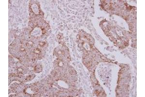 anti-Asparaginyl-tRNA Synthetase 2, Mitochondrial (Putative) (NARS2) (AA 7-276) antibody