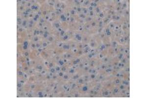 IHC-P analysis of Mouse Liver Tissue, with DAB staining. (PD-L1 anticorps  (AA 48-290))