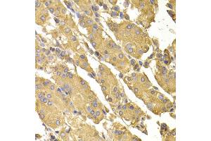 Immunohistochemistry of paraffin-embedded human stomach using PPP2CA antibody (ABIN5974047) at dilution of 1/100 (40x lens). (PPP2CA anticorps)