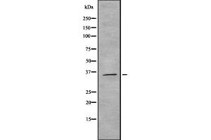 Western blot analysis of ROAA expression in HEK293 cells ,The lane on the left is treated with the antigen-specific peptide. (HNRNPAB anticorps  (N-Term))