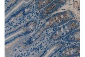 Detection of MMP9 in Rat Intestine Tissue using Polyclonal Antibody to Matrix Metalloproteinase 9 (MMP9)