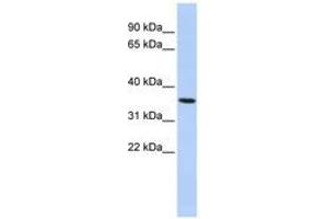 Image no. 1 for anti-Progestin and AdipoQ Receptor Family Member VI (PAQR6) (AA 72-121) antibody (ABIN6741069) (PAQR6 anticorps  (AA 72-121))