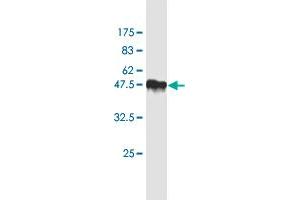 Western Blot detection against Immunogen (47. (TIMP2 anticorps  (AA 27-220))