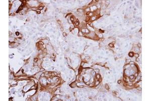 IHC-P Image Immunohistochemical analysis of paraffin-embedded CA922 xenograft, using RPSA, antibody at 1:500 dilution.