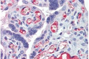 Placenta, Human: Formalin-Fixed, Paraffin-Embedded (FFPE) (HMOX1 anticorps)