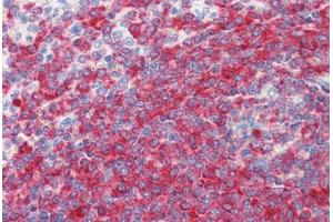 Human Spleen (formalin-fixed, paraffin-embedded) stained with PDCD4 antibody ABIN364343 at 5 ug/ml followed by biotinylated anti-mouse IgG secondary antibody ABIN481714, alkaline phosphatase-streptavidin and chromogen. (PDCD4 anticorps  (AA 1-469))