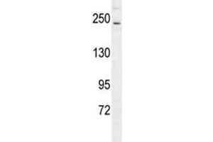 RICTOR antibody western blot analysis in mouse bladder tissue lysate.