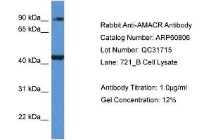 Western Blotting (WB) image for anti-alpha-Methylacyl-CoA Racemase (AMACR) (C-Term) antibody (ABIN2774297)