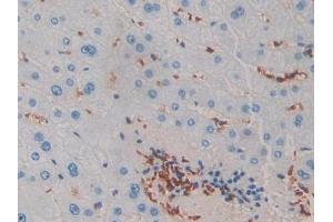 DAB staining on IHC-P; Samples: Human Liver Tissue (IL-2 anticorps  (AA 21-153))