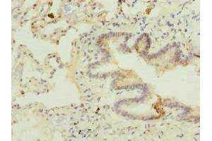 Immunohistochemistry of paraffin-embedded human lung tissue using ABIN7174888 at dilution of 1:100 (C7orf61 anticorps  (AA 1-206))