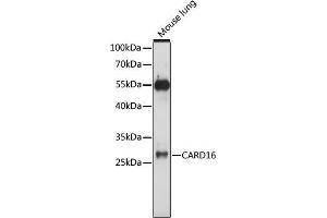 Western blot analysis of extracts of mouse lung, using C antibody (ABIN7266127) at 1:1000 dilution. (CARD16 anticorps  (AA 50-150))