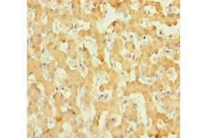 Immunohistochemistry of paraffin-embedded human liver tissue using ABIN7165010 at dilution of 1:100 (ABHD14B anticorps  (AA 2-210))