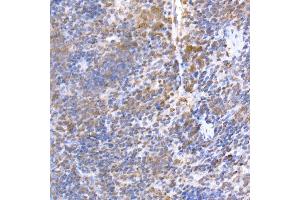 Immunohistochemistry of paraffin-embedded mouse spleen using TR Rabbit mAb (ABIN7270870) at dilution of 1:200 (40x lens). (TRAPPC2 anticorps)